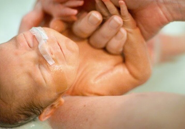 Všetko, čo potrebujete vedieť o pôrode do vody